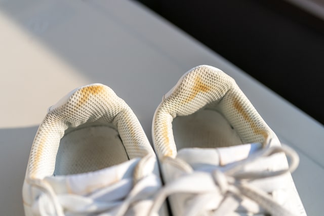 白い靴はなぜ黄ばむのか？【原因・落とす方法・予防法を解説】